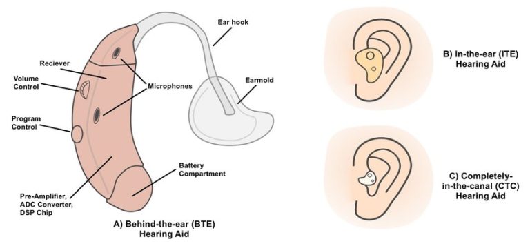 Behind-the-Ear (BTE)-Hearing-Aids